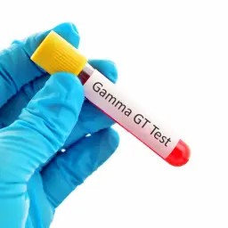 Rękawiczka w niebieskiej rękawiczce trzyma probówkę z krwią do badania GGT. Co to jest badanie GGT?