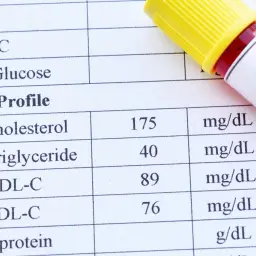 Wyniki lipidogramu: cholesterol 175, trójglicerydy 40, HDL-C 89, LDL-C 76 mg/dL. Badania lipidogram co to za badania?