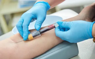 Pobieranie krwi do badań, które mogą wykazać złe wyniki prób wątrobowych.