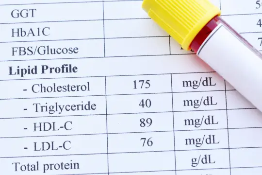 Wyniki lipidogramu: cholesterol 175, trójglicerydy 40, HDL-C 89, LDL-C 76 mg/dL. Badania lipidogram co to za badania?