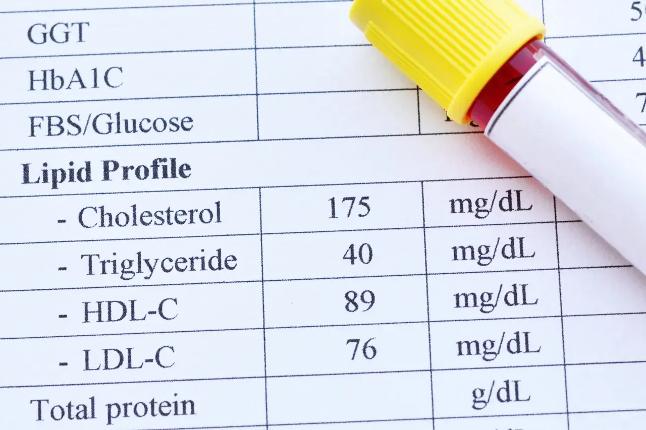 Lipidogram - jak czytać LDL, HDL i trójglicerydy?